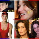 carla bruni botox