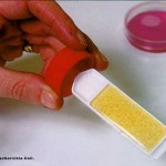 infection urinaire et homéopathie