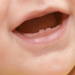 comment soulager la poussée dentaire ?