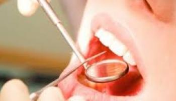 conseils après une extraction dentaire